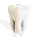 Molar tooth white and yellow