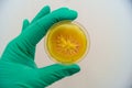 Mold grown on a Sabouraud agar medium in a Petri dish