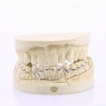 Mold of of human teeth Royalty Free Stock Photo