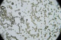 Mold spores under the light microscope Royalty Free Stock Photo