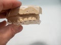 MOLD OF THE TEETH OF A CHILD WITH MISPLACED TEETH AN ORTHODONTIC Royalty Free Stock Photo