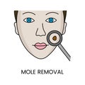 Mole removal with laser cosmetology, in vector woman face with nevus