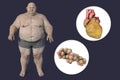 Molecule of cholesterol and obese heart in overweight man, 3D illustration. Concept of obesity and inner organs disease