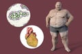 Molecule of cholesterol and obese heart in overweight man, 3D illustration. Concept of obesity and inner organs disease