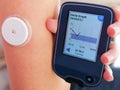 Moment of reading a glucose levels using device for continuous glucose monitoring in blood Ã¢â¬â CGM.