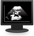 Monitor echography