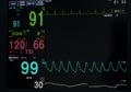 Monitor vital sign and EKG monitor in ICU unit ,it show The waves of blood pressure, blood oxygen saturation, ECG,heart rate,res