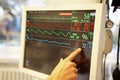 Monitor of vital signs