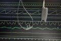 Monitoring of patient in hospital. Royalty Free Stock Photo