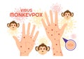 Monkey Pox Outbreak Vector Illustration of Virus Symptoms in Humans Monkeypox Microbiological in Flat Cartoon Hand Drawn Templates