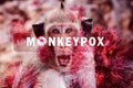 Monkeypox outbreak concept. Monkeypox is caused by monkeypox virus. Monkeypox is a viral zoonotic disease. Virus transmitted to