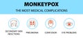 Monkeypox virus icons infographic. The most medical complications. New outbreak cases in Europe and USA