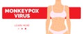 Monkeypox virus outbreak female body torso rash vector