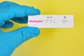 Monkeypox virus positive by using rapid diagnostic kit Royalty Free Stock Photo