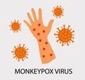 Monkeypox virus zoonotic viral disease that can infect human, nonhuman primates. Monkey pox. Vector illustration