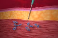 Monoclonal antibody treatment (Adalimumab) - closeup view 3d illustration