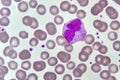 Monocyte cell in blood smear