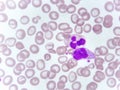 Monocyte and neutrophil cell in blood smear