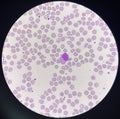 Monocyte white blood cells on center