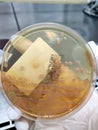 Morganella morganii, sample culture - Microbiology