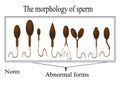 Morfológia z spermie 