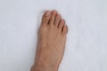 Morton's toe on snow.