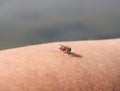 Mosquito bites into hand skin