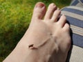 A mosquito is feeding on blood from a person& x27;s foot