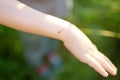 Mosquito sitting on the hand of child. Gnat sucking blood. Danger of bite of an insect. Use repellent for safety kids