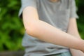 Mosquito sitting on the hand of child. Gnat sucking blood. Danger of bite of an insect. Use repellent for safety kids