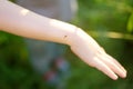 Mosquito sitting on the hand of child. Gnat sucking blood. Danger of bite of an insect. Use repellent for safety kids Royalty Free Stock Photo