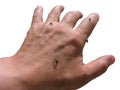 Mosquitos on the hand