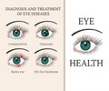 Most common eye problems.