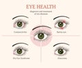 Most common eye problems.