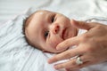 mother applying antiallergic cream at baby face with skin rash and allergy Royalty Free Stock Photo