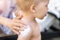 Mother applying sunscreen protection creme on cute little toddler boy shoulder. Mom using sunblocking lotion to protect baby from