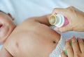 Mother applying vanishing medicine for infant to prevent stomachache. Baby have a stomach ache Royalty Free Stock Photo