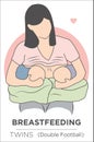 Mother Breastfeeding Her Twins: Double Football Breastfeeding Pose