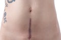 Mother's Recovering C-Section Scar With Tattoo Royalty Free Stock Photo