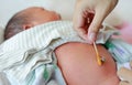 Mother use cotton swab moistened with alcohol to wipe clean the navel umbilical cord baby newborn