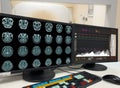 Blur Medical CT or MRI or PET Brain Scan film on a computer monitor. Technologically advanced and functional medical office Royalty Free Stock Photo