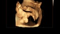 Motion of 4D Ultrasound Echography of baby un mother's womb. Life concept, scientific discovery