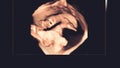 Motion of 4D Ultrasound Echography of baby un mother`s womb. Life concept, scientific discovery