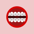 Mouth with braces isolated. correction of occlusion and crooked teeth