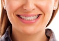 Mouth care teeth with braces