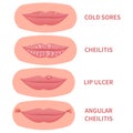 Mouth disease medical set of sore lips icons