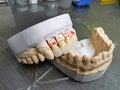 Mouth model with porcelain teeth Royalty Free Stock Photo