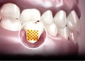 Mouth, teeth, gums. Sensitive teeth, withdrawal of the gingiva. Dental sensitivity.