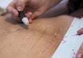 Moxibustion procedure at health centers. Alternative medicine therapist doing moxa treatment on her client. Royalty Free Stock Photo