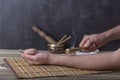 Moxibustion therapy - Traditional Chinese Medicine. Placement of the burning moxa stick on the arm. Royalty Free Stock Photo